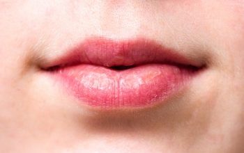 Everything To Know About Lip Filler And Lip Augmentation